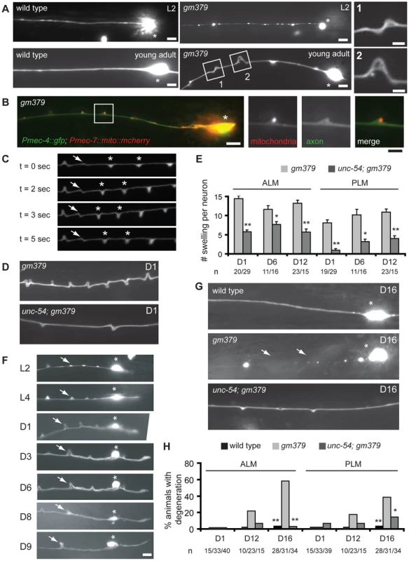 Axon pathology of the touch neurons in the <i>gm379</i> mutant.
