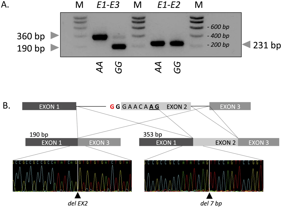 Effect of the c124-2A>G splice site variant on <i>RNF11</i> transcripts.