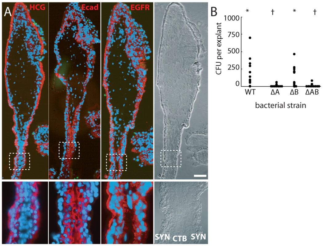 Bacteria invade primarily via InlA binding to E-cadherin on cytotrophoblasts not covered by syncytiotrophoblast.