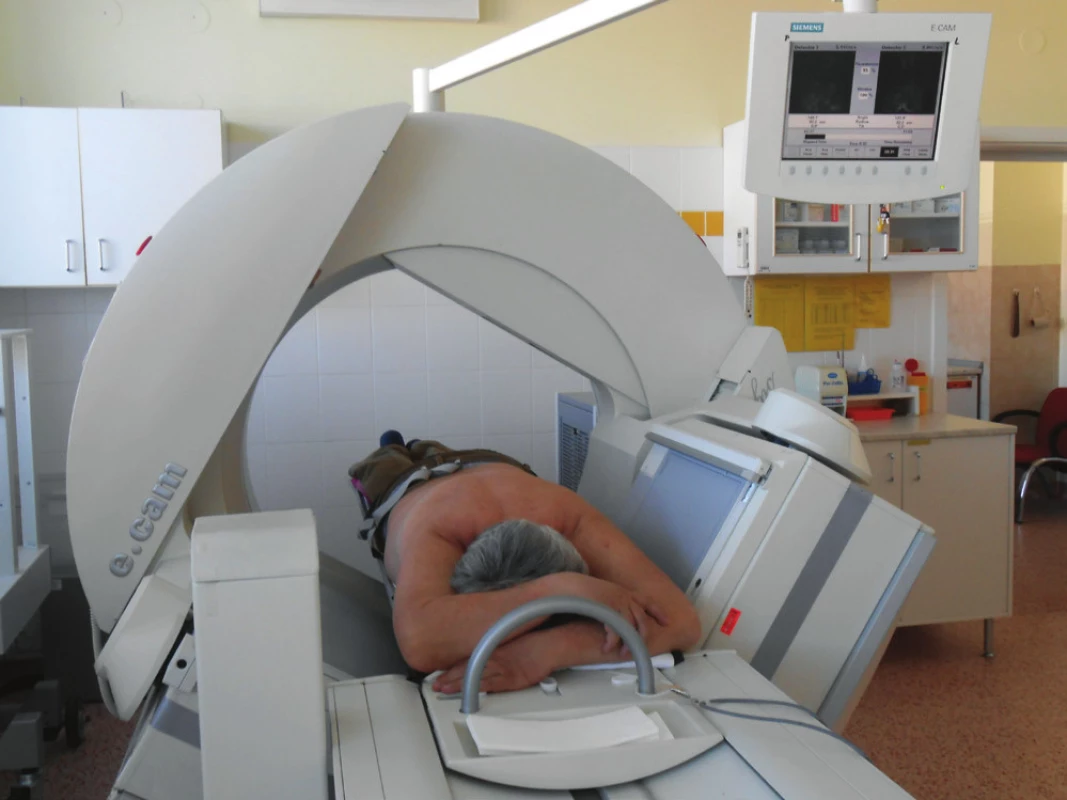 Pozice pacienta při vyšetření SPECTu myokardu vleže na břiše - prone projekce.