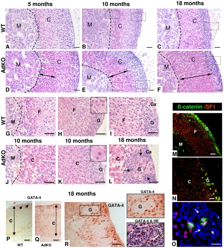 Morphological defects and progressive hyperplasia in AdKO adrenals.