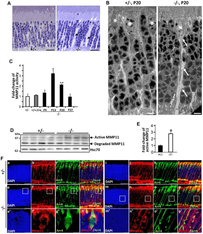 Activation of matrix metalloproteinase 11 (MMP11) upon ablation of <i>Ranbp2</i> in cone photoreceptors.