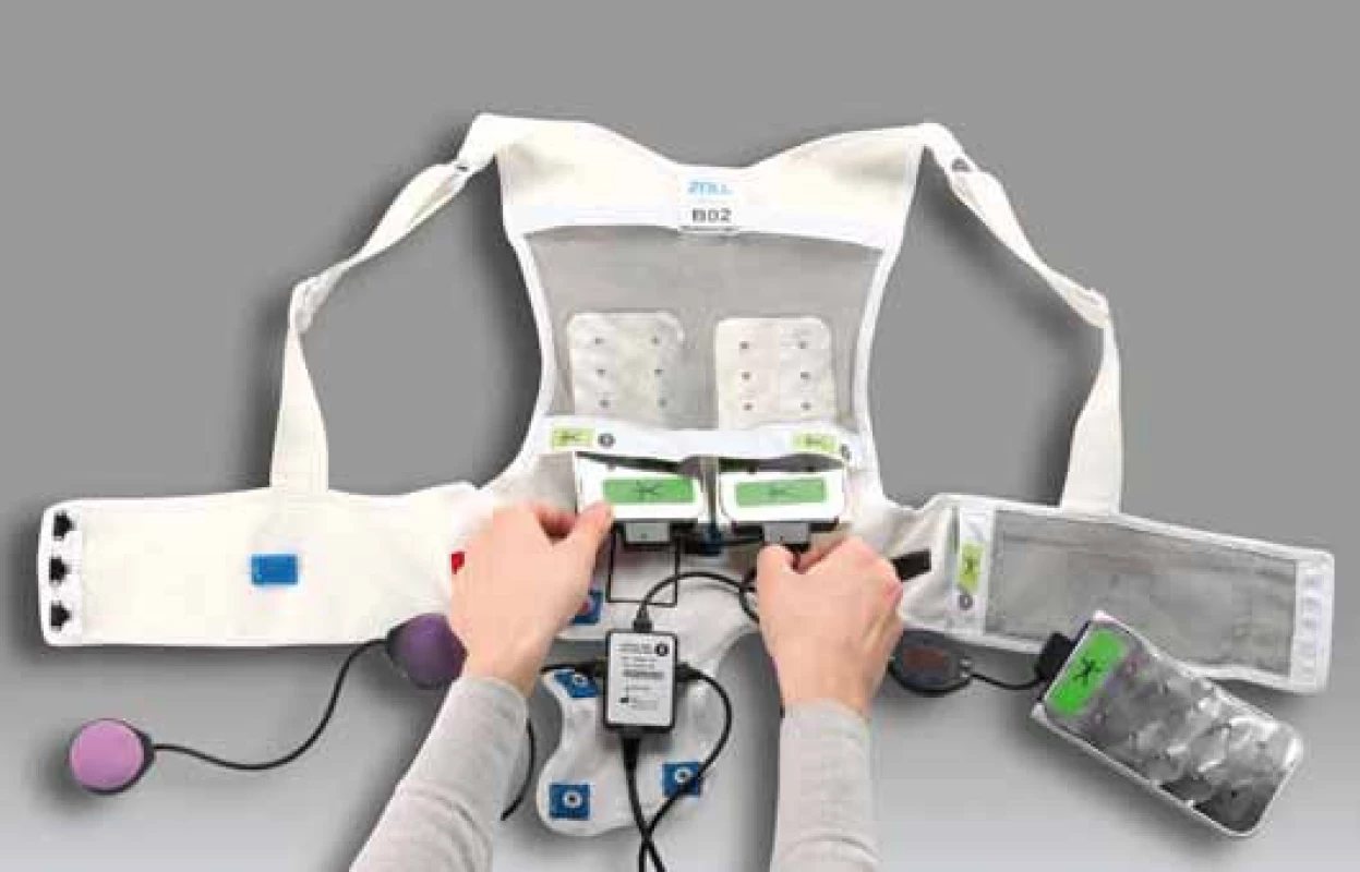 Wearable kardioverter defibrilátor.