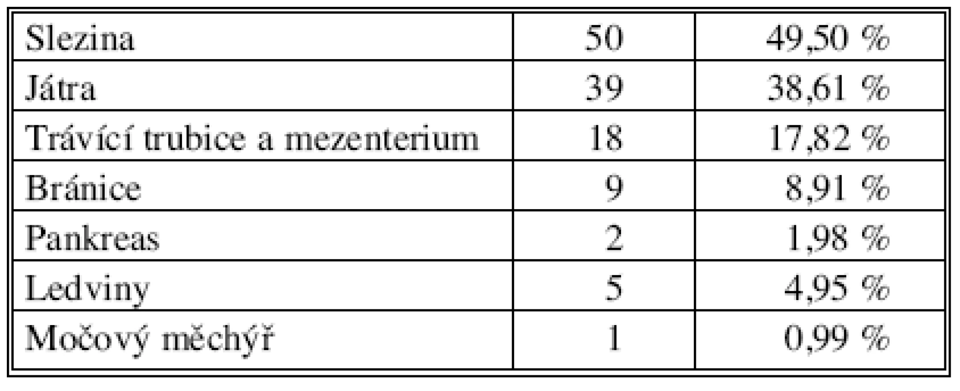 Poranění nitrobřišních orgánů v souboru (n = 101)
Tab. 2. Intraabdominal injuries in the study group ( n = 101)