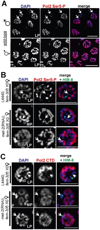 X chromosome-specific transcriptional regulation is specified by chromatin architecture and is disrupted in <i>met-2(RNAi)</i>;<i>fem-3(lf)</i> X0 germ lines.