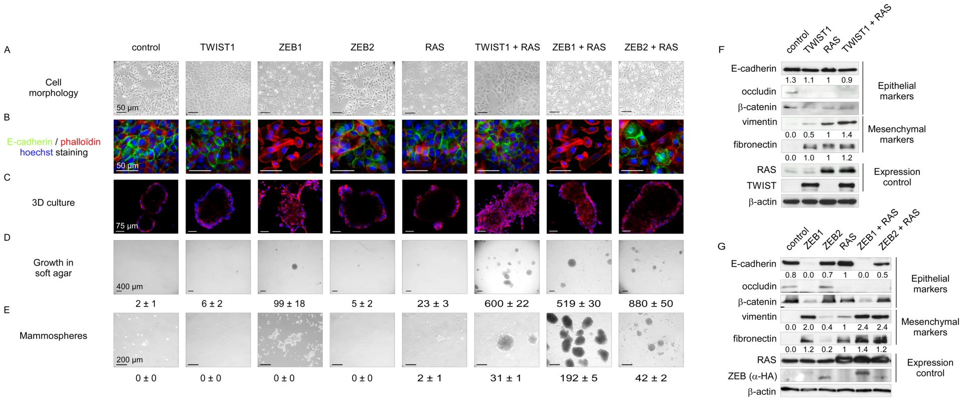 EMT induction by embryonic transcription factors facilitates HMEC transformation by an activated form of RAS.