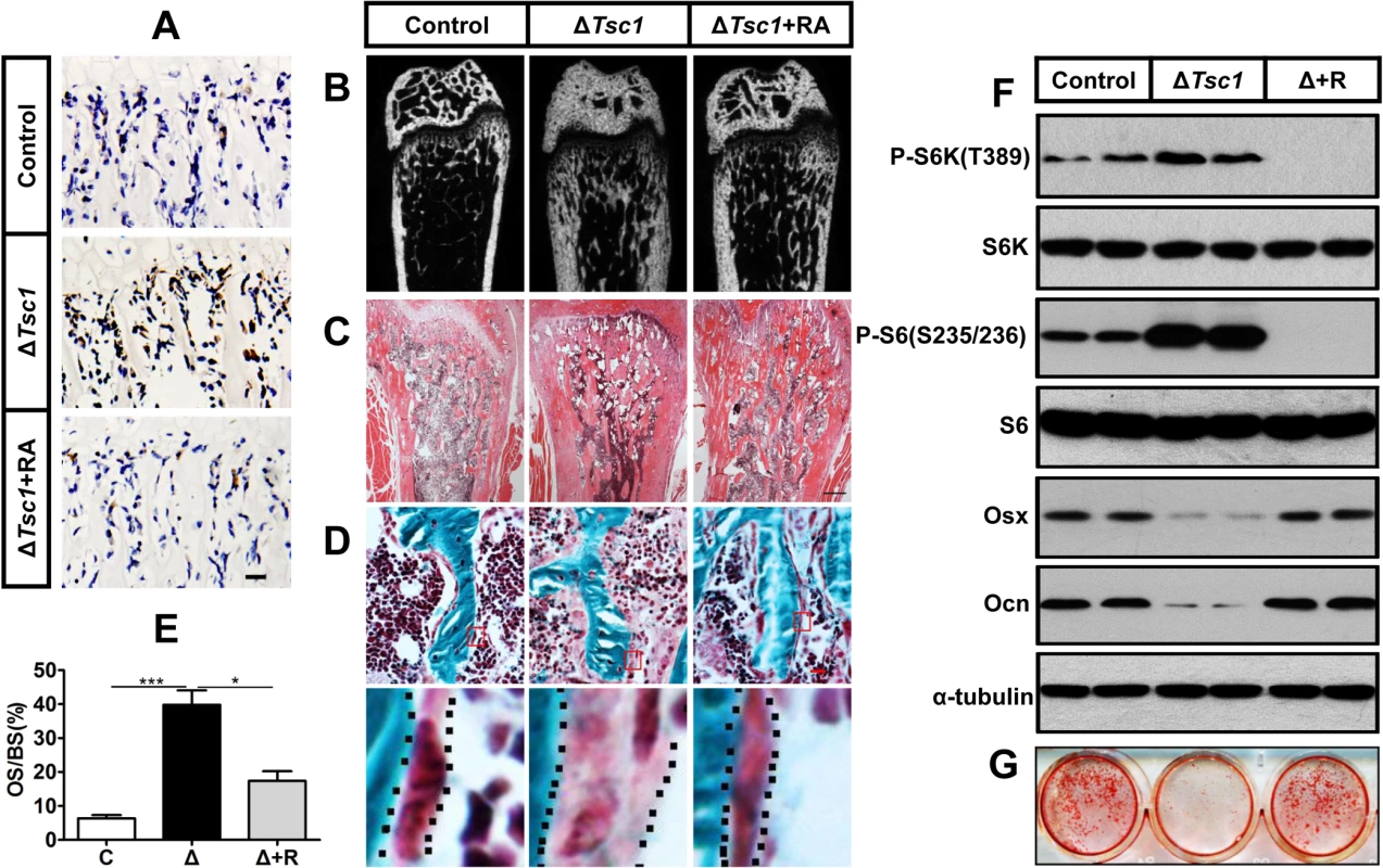 Rapamycin reverses phenotypes in Δ<i>Tsc1</i> mice.