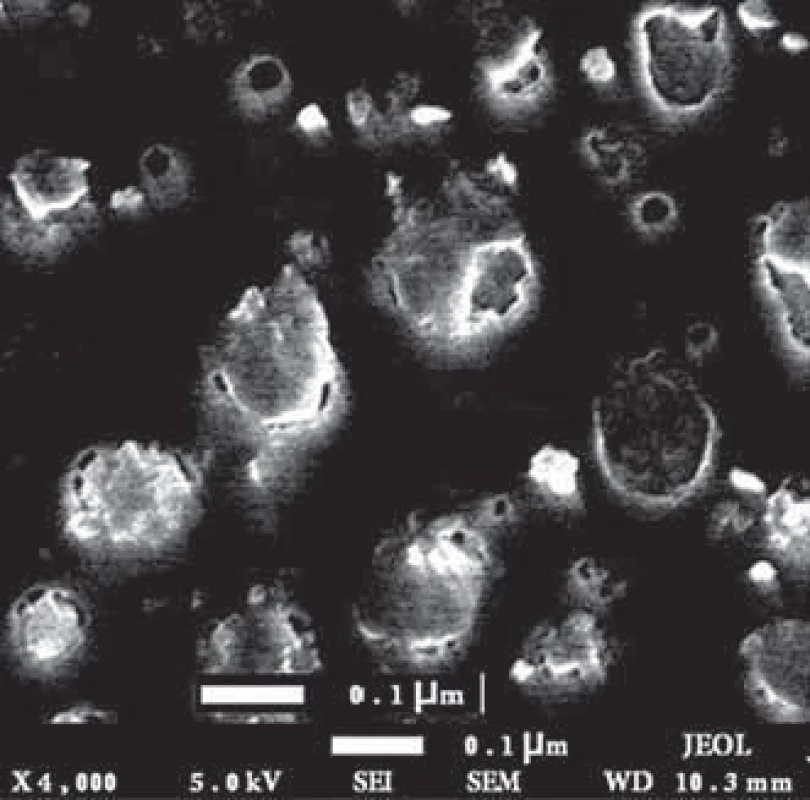 Exosomes isolated from MCF-7 breast cancer cells‘ supernatant. As can be seen in the fi gure, these exosomes are spherical and have a size in the range of 30–150 nm.