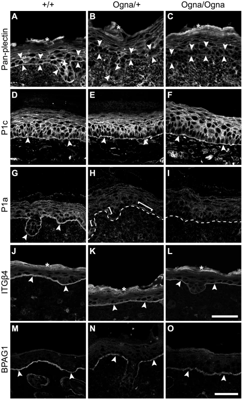 Immunolocalization of HD proteins on frozen leg skin sections from 1-day-old wild-type and mutant mice.