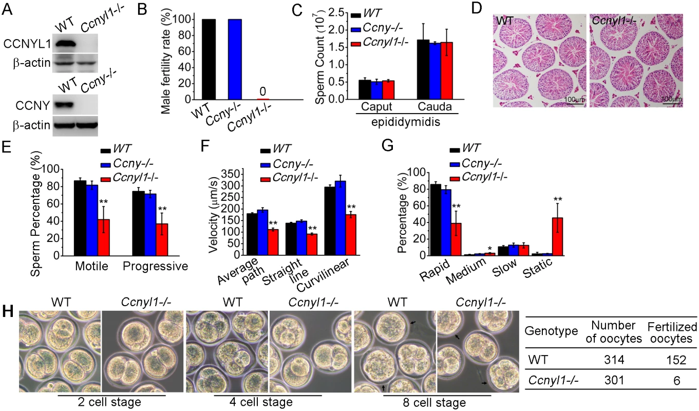 Essential function of CCNYL1 for male fertility and sperm motility.