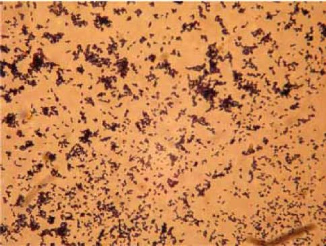 Kmen 16A/1 Lactobacillus fermentum.