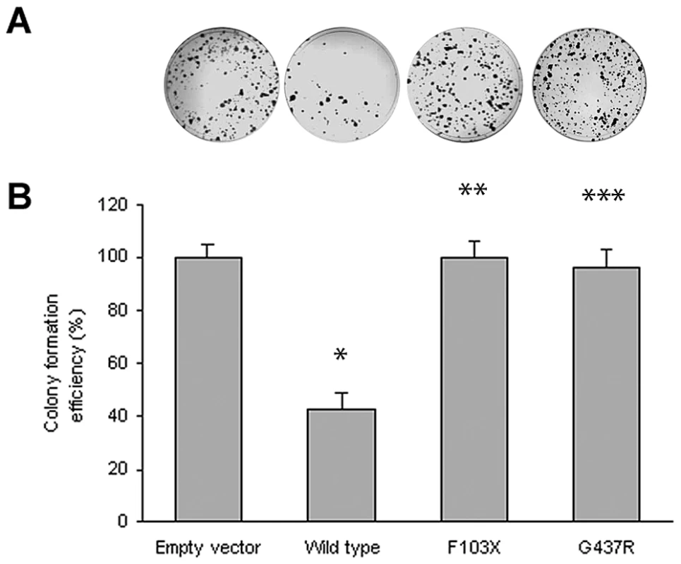 Colony formation assays of <i>SLC29A3</i>.