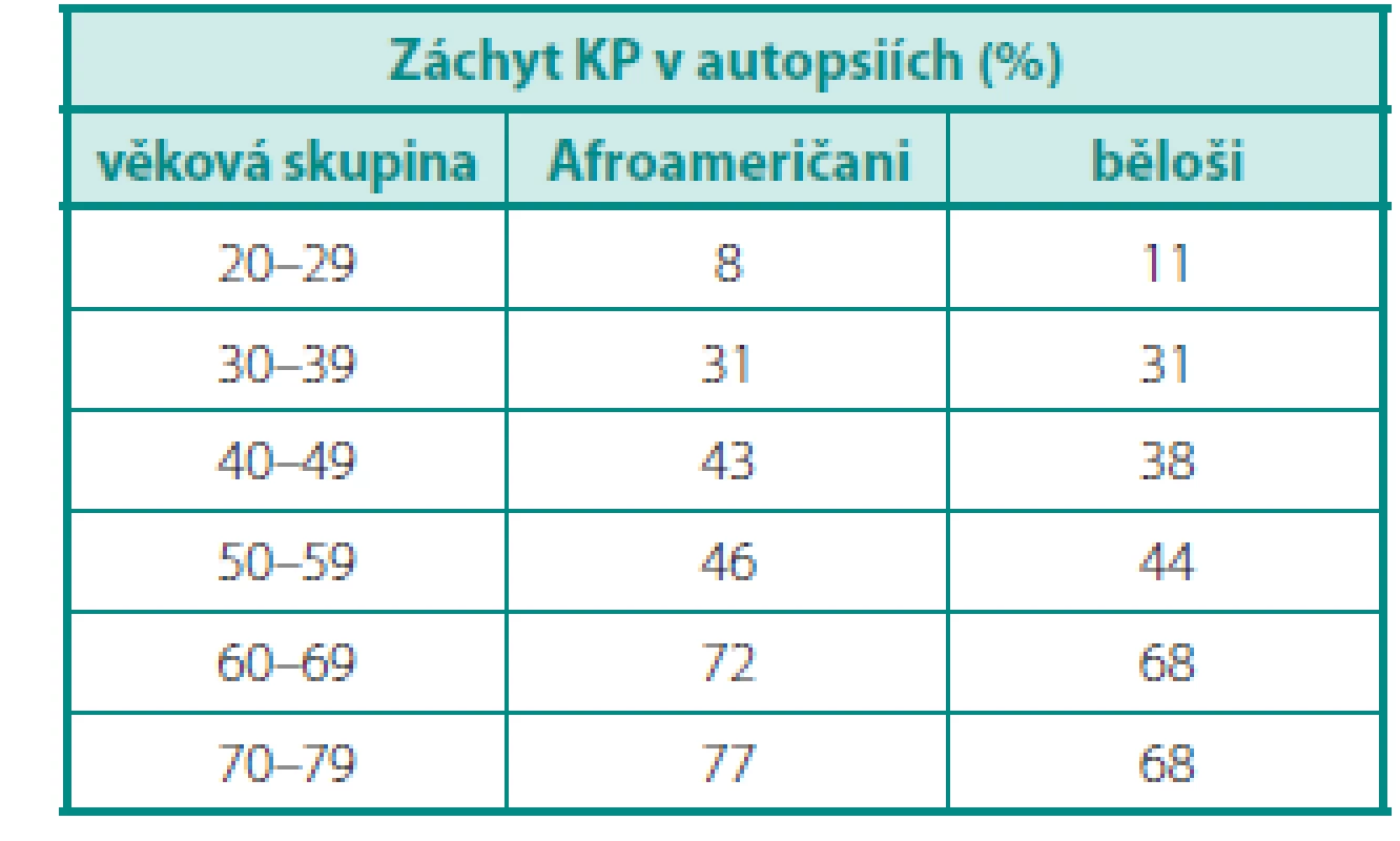 Prevalence karcinomů prostaty v autopsiích (upraveno dle (4)) Table 1. Prostate cancer prevalence on autopsy (according to (4))