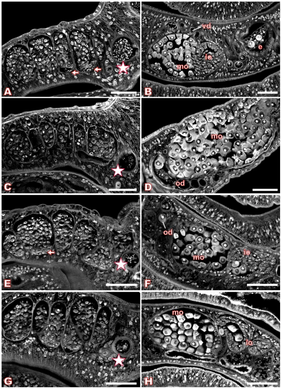 Morphology of the testes and ovary of Piceatannol- or dsRNA-treated <i>S. mansoni</i>.