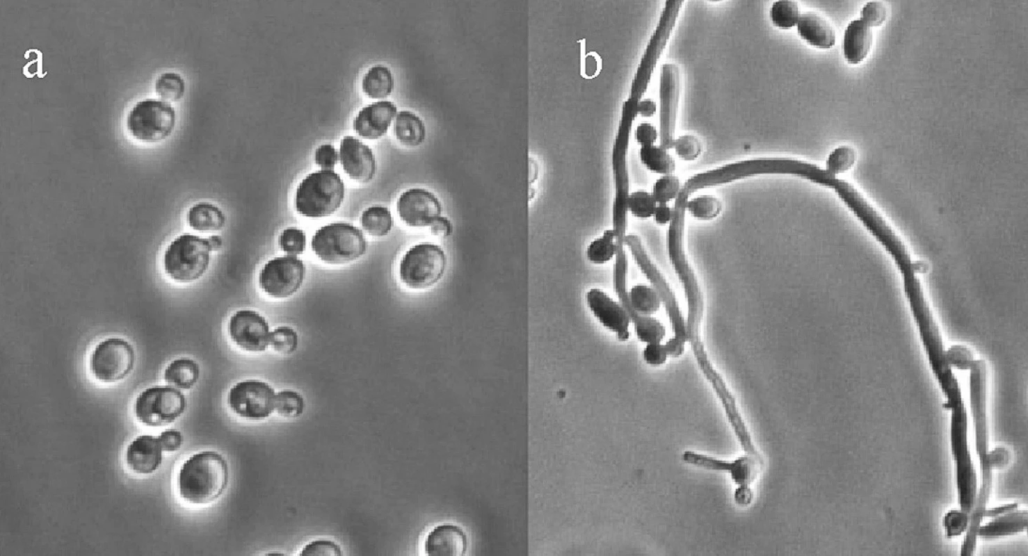 Candida albicans: a) kvasinka jako oválná buňka, b) pseudohyfy<sup>19</sup>)