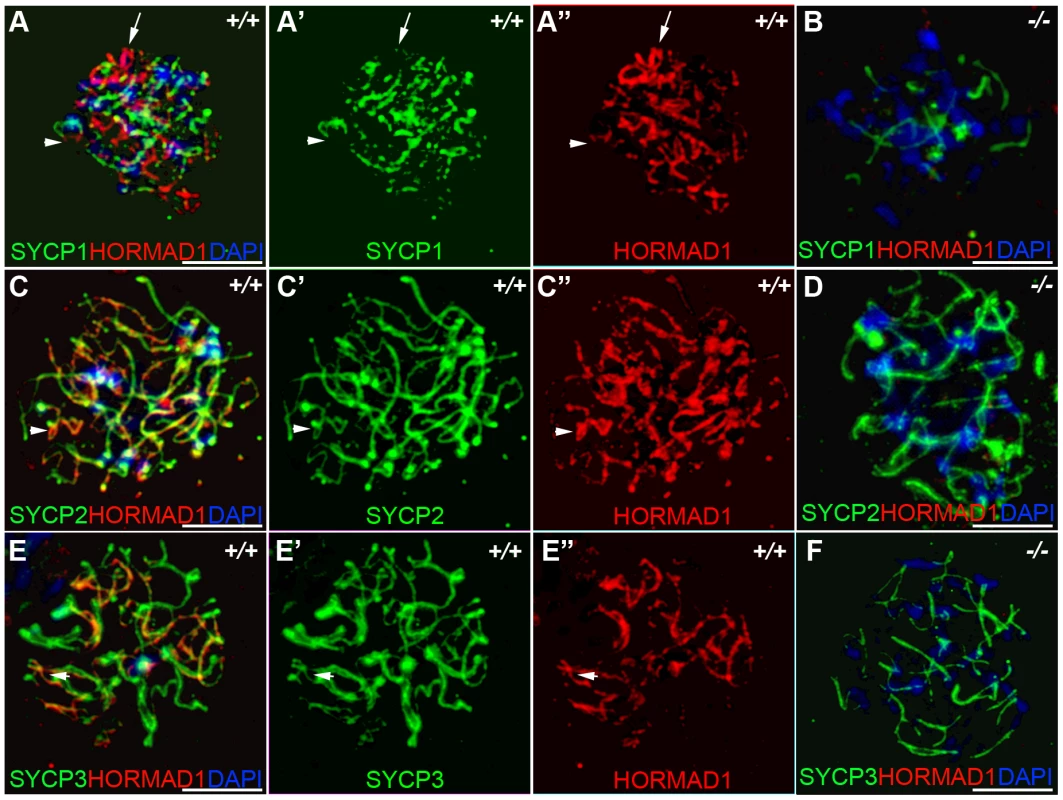 HORMAD1 co-localizes with SYCP2 and SYCP3, but not with SYCP1.