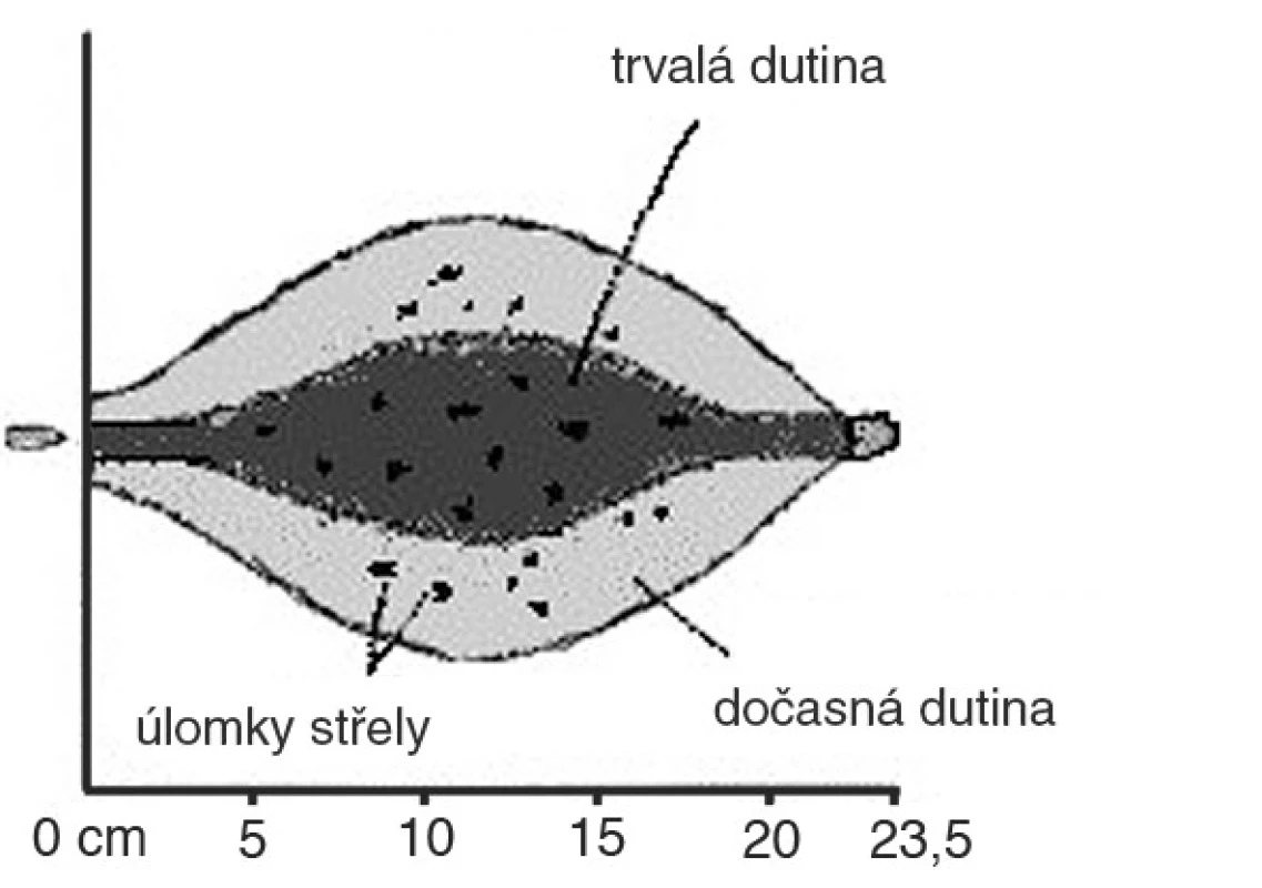 Profil rány střely 5,56 mm SP (typ dum-dum)
Fig. 2. Wound profile of bullet Cal. 5.56mm SP