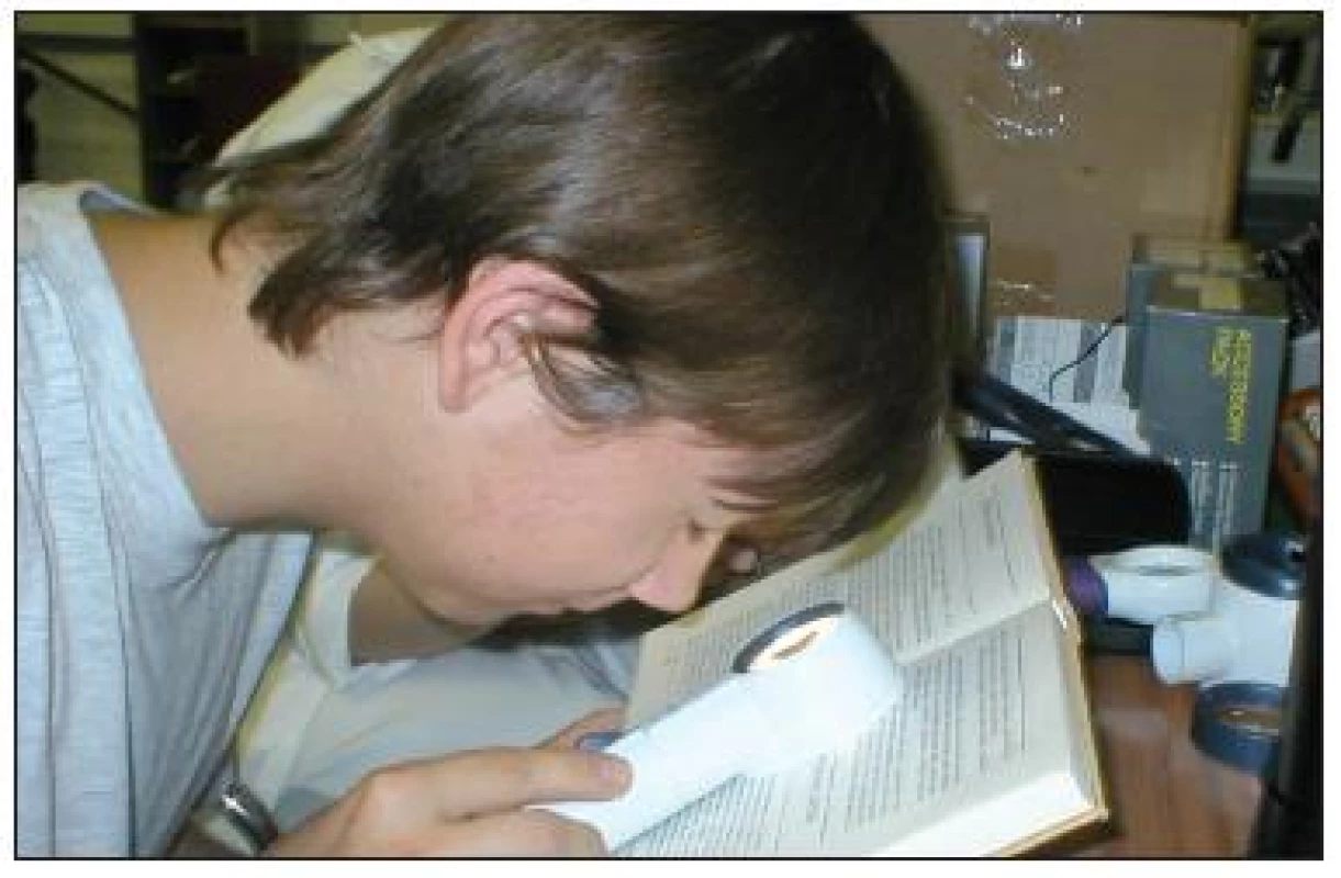 Príložná lupa s osvetlením