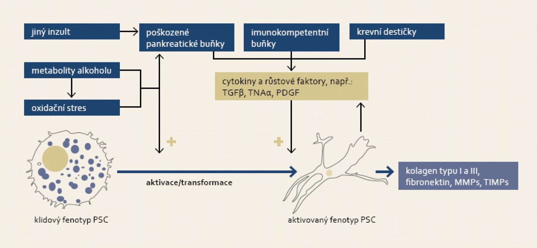 K aktivaci pankreatických stelárních buněk (PSC) dochází jak přímým vlivem metabolitů alkoholu a jimi indukovaným oxidačním stresem, tak i působením cytokinů a růstových faktorů emitovanými imunokompetentními buňkami a stromálními buňkami pankreatu při zánětu. Proces aktivace je morfologicky charakteristický změnou tvaru buňky a ztrátou tukových kapének.
Fig. 4. Activation of pancreatic stellate cells (PSC) is triggered either by alcohol metabolites and subsequent oxidative stress, or by action of cytokines and growth factors secreted by immunocompetent and stromal pancreatic cells accompanying inflammation. Activation of PSC is accompanied by its morphological change and loss of fat droplets.