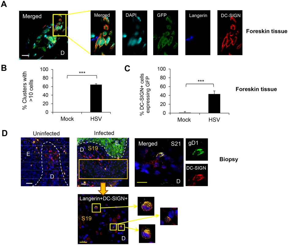 Interaction of HSV-1 infected LCs with DC-SIGN<sup>+</sup> dermal cells (dermal DCs/macrophages).