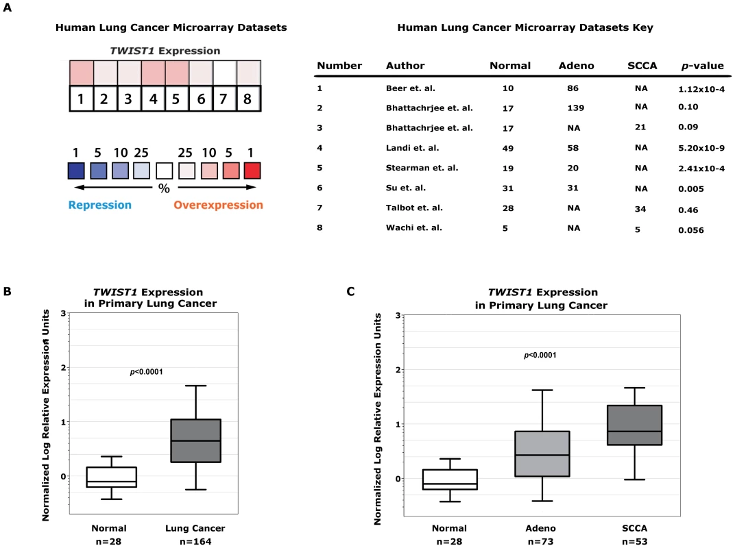 <i>TWIST1</i> is overexpressed in human primary lung cancers.
