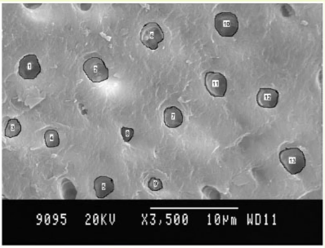 Fluorosed healthy specimens.