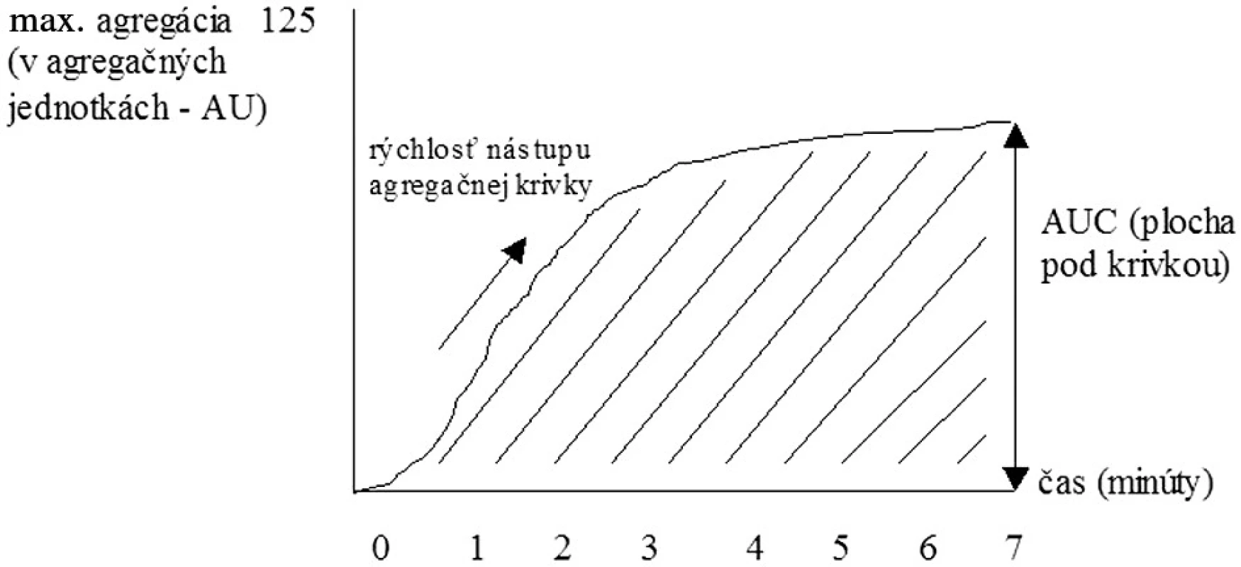 Sledované parametre při impedančnej agregometrii.
