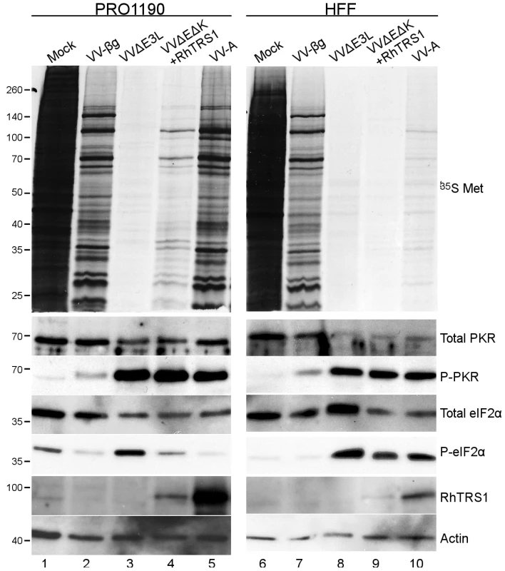 Effects of RhTRS1 overexpression on the PKR pathway in PRO1190 or HFF.