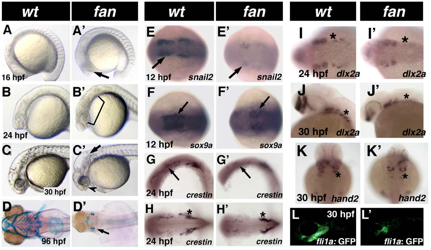 Phenotype of <i>fan</i> mutants.