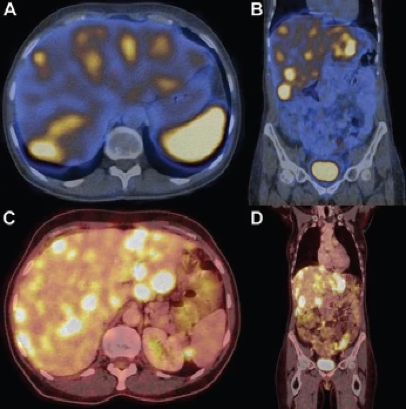 SPECT/CT and PET/CT imaging.