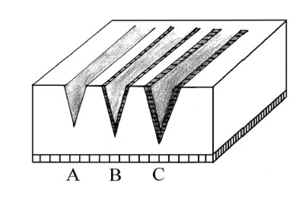 Řez tkání v základních režimech.
A–řez v režimu cut. Precizní řez bez hemostázy. B–řez v režimu cut/coag (blend). Méně precizní řez s variabilním poškozením laterálních okrajů při dostatečné hemostáze. C–řez v režimu coag. Řez se značným termálním poškozením okrajů.