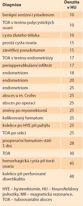 Denzity obsahu tekutinových kolekcí u pacientek vyšetřovaných pro podezření na zánětlivou komplikaci v oblasti pánve s ověřeným nálezem buď operačně a histologicky či jinou zobrazovací metodou (nejčastěji MR).
