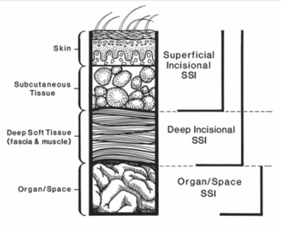 Schéma klasifikace IMOV [11]
Fig. 1: Schema of classification SSI [11]