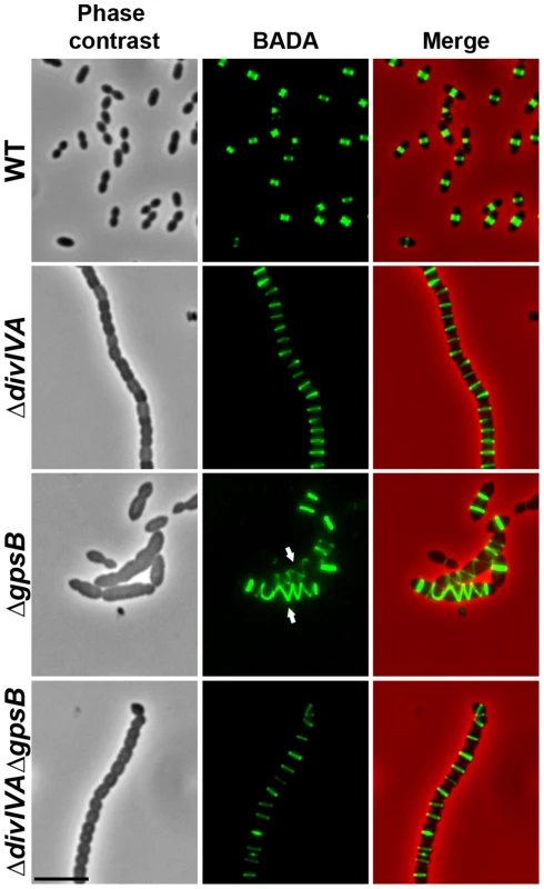 Localization of PG synthesis in WT, Δ<i>divIVA</i>, Δ<i>gpsB</i> and Δ<i>divIVA</i>Δ<i>gpsB</i> cells.