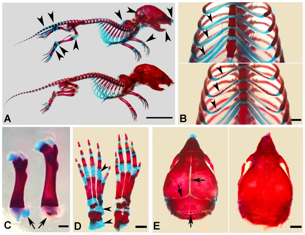 Alizarin red/alcian blue staining of the skeleton in the 1-week-old <i>Sox2-Cre-Fam20c</i>-cKO mice.