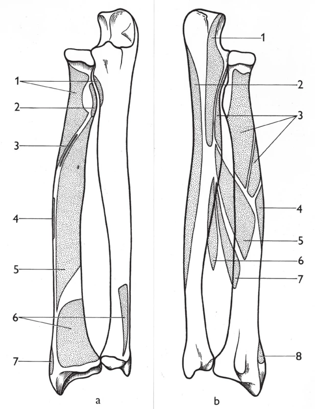 Začátky a úpony svalů na radiu a ulně: a – volární plocha, 1 – m. supinator, 2 – m. biceps brachii, 3 – m. flexor digitorum superficialis (caput radiale), 4 – m. pronator teres, 5 – m. flexor pollicis longus, 6 – m. pronator quadratus, 7 – m. brachioradialis; b – dorzální plocha, 1 – m. anconeus, 2 – m. flexor carpi ulnaris, 3 – m. supinator, 4 – m. pronator teres, 5 – m. abductor pollicis longus,  6 – m. extensor pollicis longus, 7 – m. extensor pollicis brevis, 8 – brachioradialis. <i>(Převzato z Bartoníček J. Operační přístupy u zlomenin hlavičky a diafýzy rádia. Acta Chir Orthop Traumatol Čech 1988;55:497−516.)</i>
Fig. 4: Muscle origins and insertions on radius and ulna: a – volar (anterior) surface, 1 – supinator, 
2 – biceps brachii, 3 – flexor digitorum superficialis (radial head), 4 – pronator teres, 5 – flexor pollicis longus, 6 – pronator quadratus, 7 – brachioradialis; b – posterior surface, 1 –anconeus, 
2 – flexor carpi ulnaris, 3 – supinator, 4 – pronator teres, 5 – abductor pollicis longus, 6 – extensor pollicis longus, 7 – extensor pollicis brevis, 8 – brachioradialis. <i>(Reprinted from Bartoníček J. [Surgical approaches in fractures of the head and shaft of radius]. Acta Chir Orthop Traumatol Čech 1988;55:497−516.)</i>