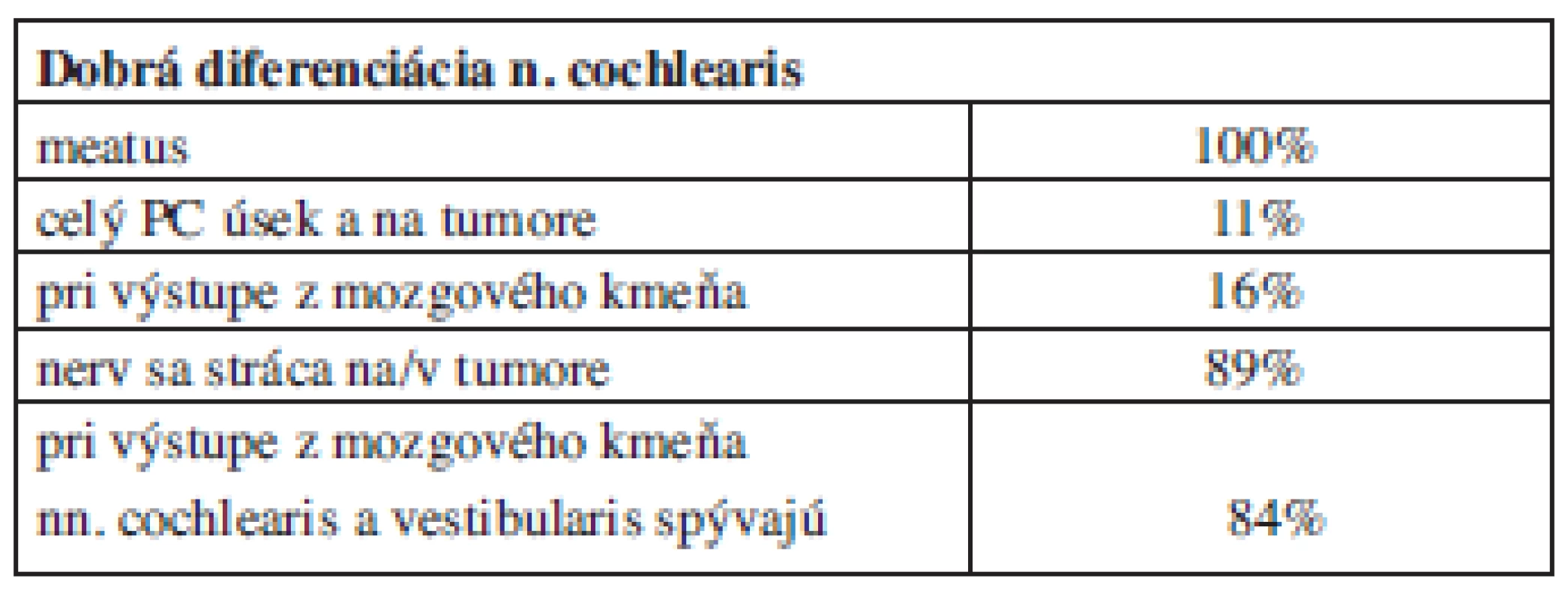 Dobrá diferenciácia n. cochlearis.