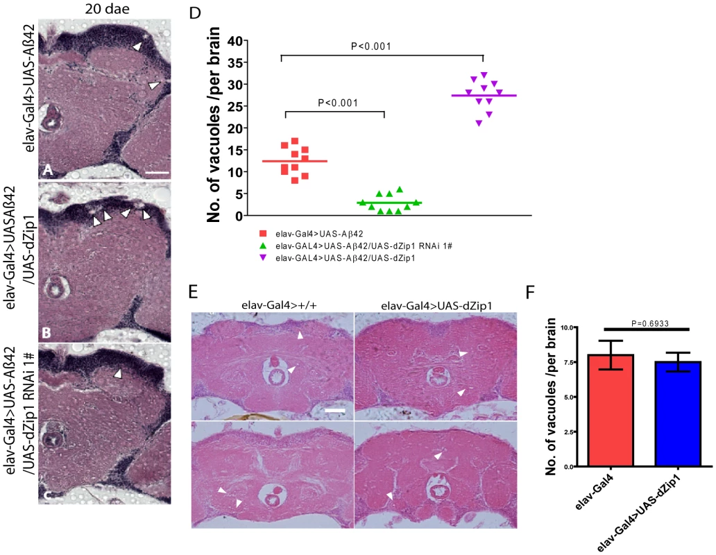 Aβ42-induced neurodegeneration is ameliorated by <i>dZip1</i> RNAi but exacerbated by <i>dZip1</i> overexpression.