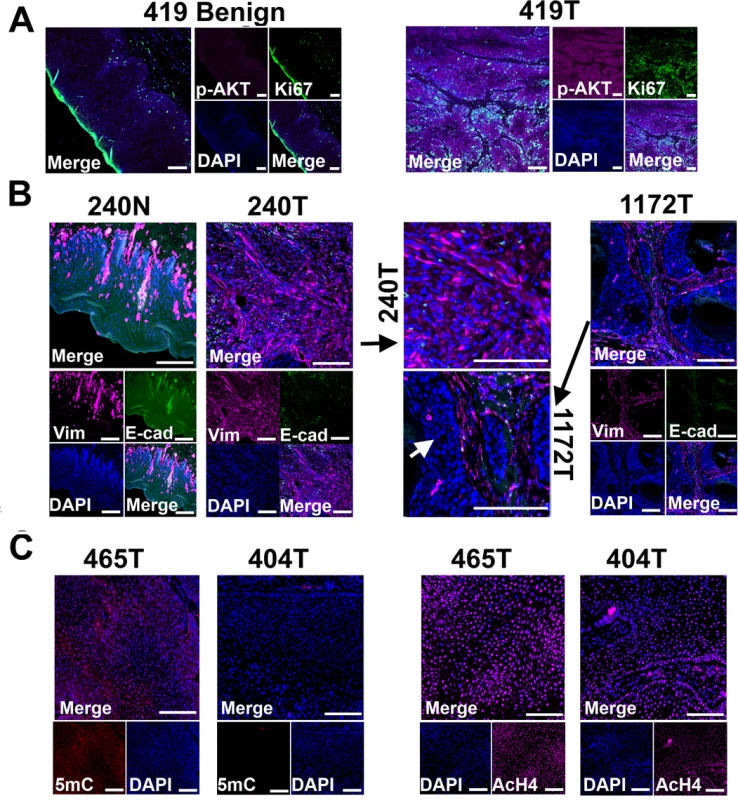 Tissue immunofluorescent staining supports conclusions from RNA-seq studies shown in <em class="ref">Fig 3</em>.