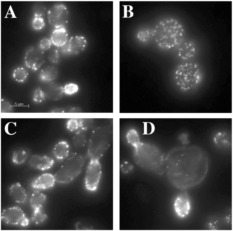 Actin staining of complex hemizygotes.