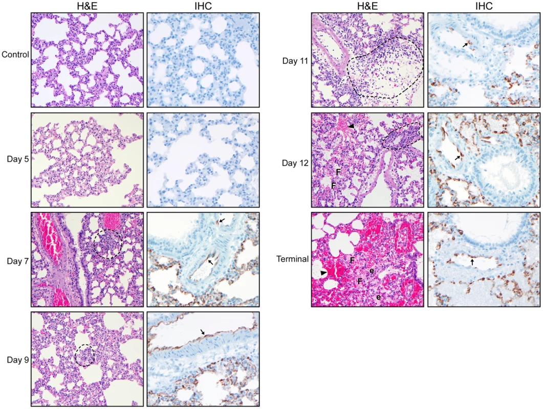 Histological examination of lungs from Andes infected hamsters.