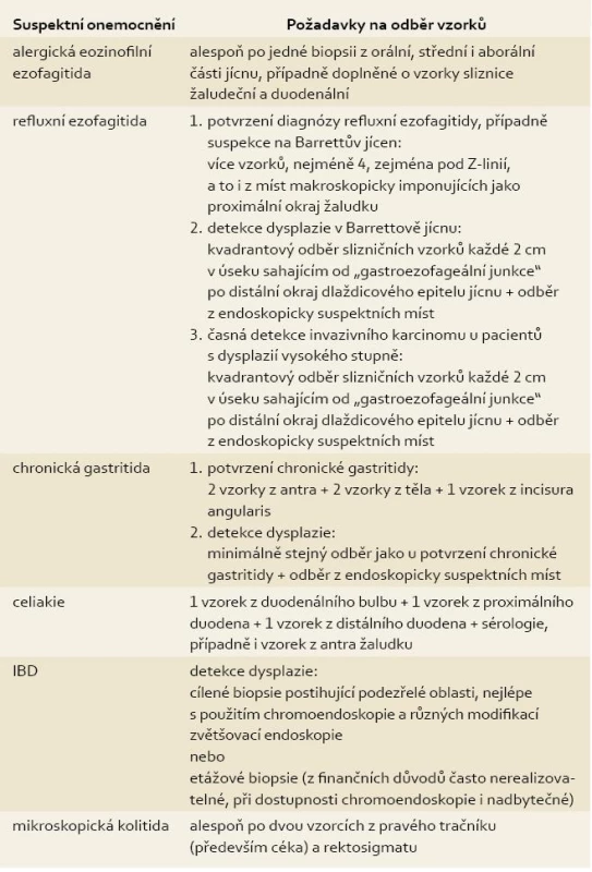 Pokyny k odběru materiálu při endoskopickém vyšetření GIT .
Tab. 1. Suggestion of obtaining biopsies during endoscopic investigation of GIT.