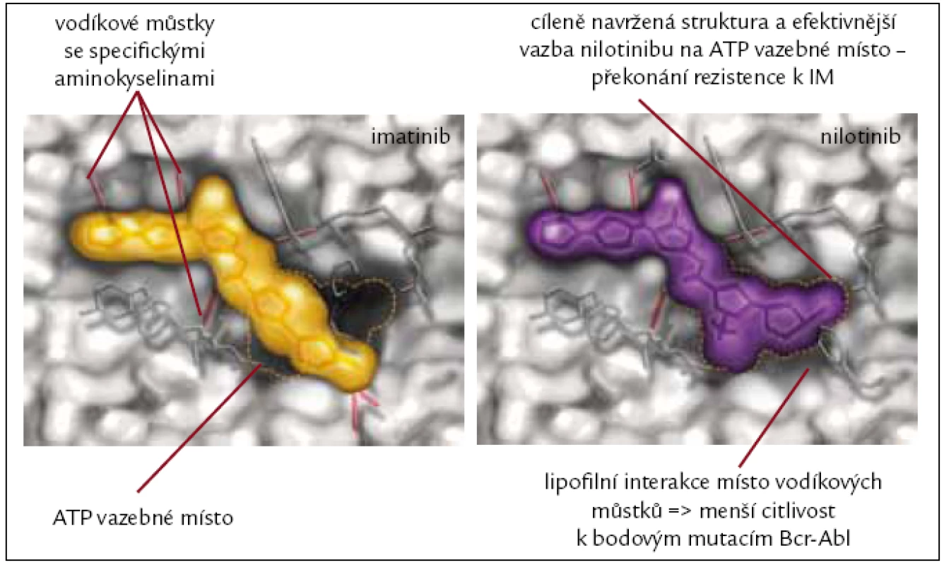 Rozdíly ve vazebných místech jsou příčinou účinnosti nilotinibu i v případě rezistence k imatinibu.