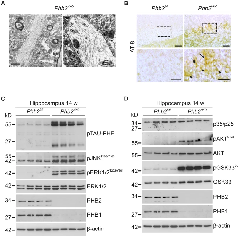 Tau hyperphosphorylation and filaments in <i>Phb2<sup>NKO</sup></i> mice.