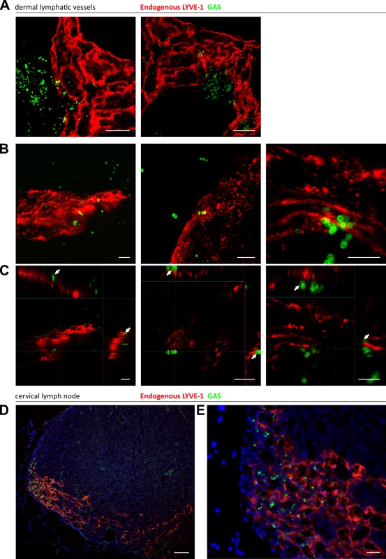 Trafficking of GAS visualized in dermal lymphatic vessels and draining cervical lymph nodes of the mouse ear pinna.