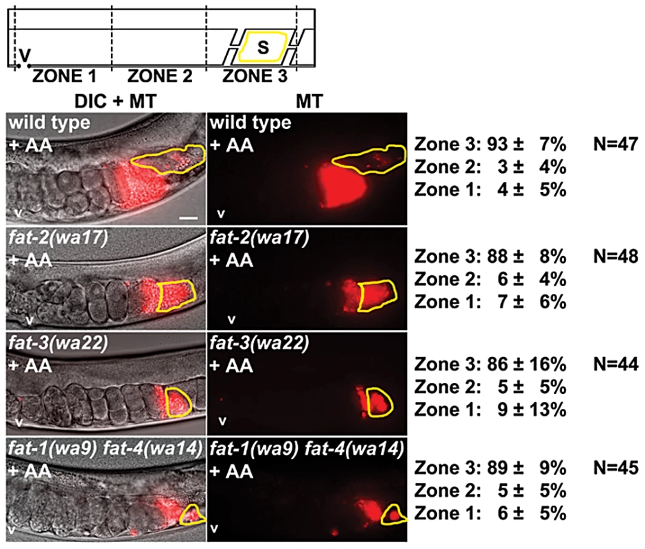 Effect of AA supplementation on sperm guidance in wild-type and <i>fat</i> mutant hermaphrodites.