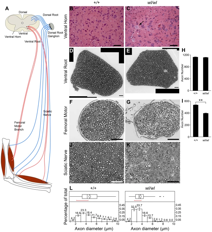 Characteristics of axonopathy in <i>wl/wl</i> mice.