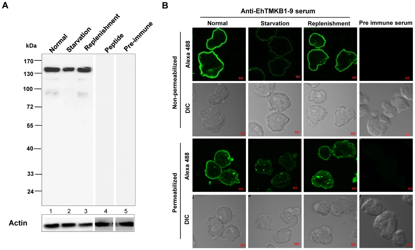 Expression and immunolocalization of EhTMKB1-9 in <i>E. histolytica</i>.