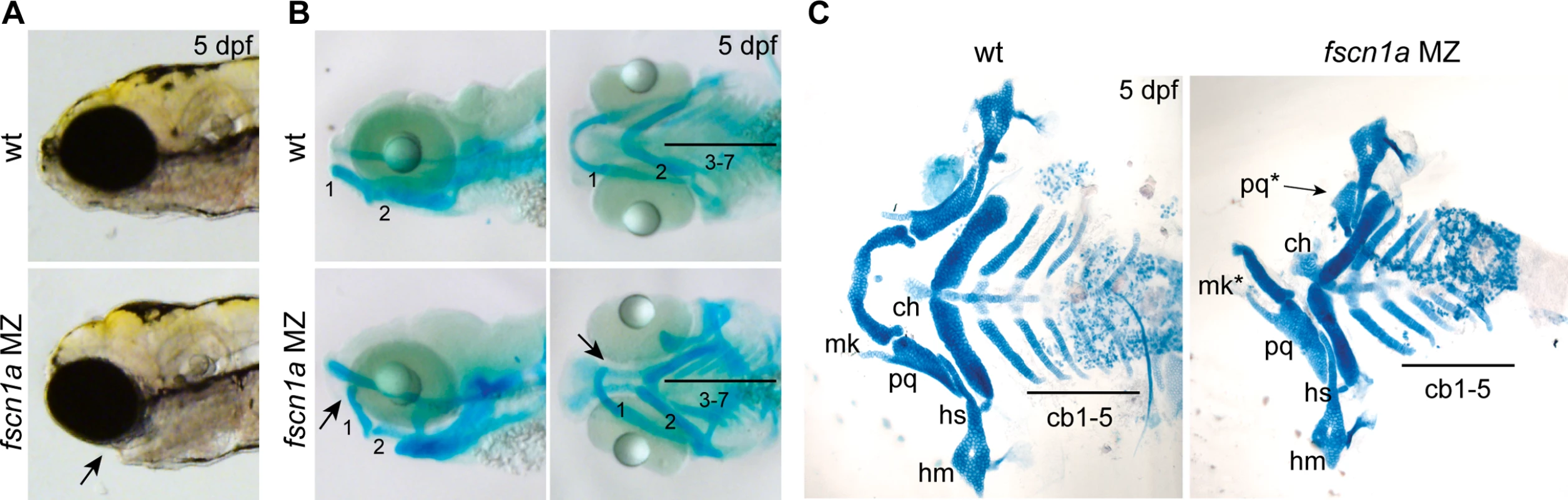 <i>fscn1a</i> is required for development of NC-derived craniofacial cartilage.