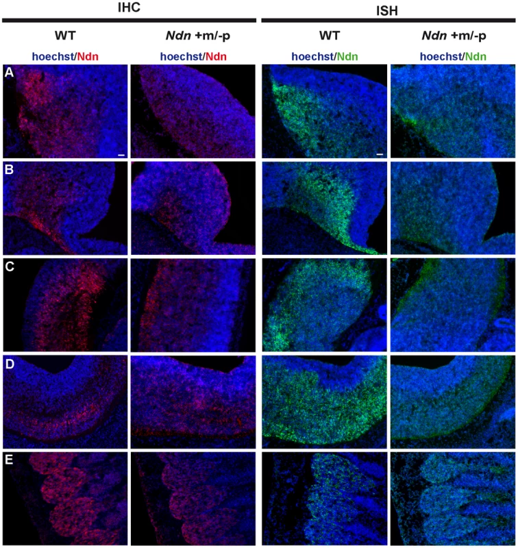 <i>Ndn</i> expression in <i>Ndn+m/−p</i> E12.5 embryos.